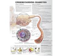 Understanding Diabetes Anatomical Chart