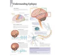 Understanding Epilepsy Laminated Poster