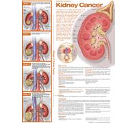 Understanding Kidney Cancer Anatomical Chart