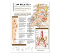 Understanding Low Back Pain Anatomical Chart