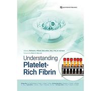 Understanding Platelet-rich Fibrin