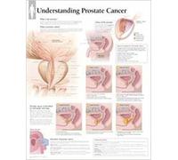 Understanding Prostate Cancer Laminated Poster