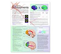 Understanding Schizophrenia Anatomical Chart