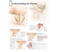 Understanding the Prostate Laminated Poster
