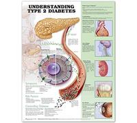 Understanding Type 2 Diabetes Anatomical Chart