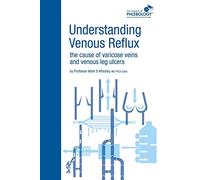 Understanding Venous Reflux the Cause of Varicose Veins and Venous Leg Ulcers (College of Phlebology)