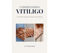 Understanding Vitiligo: A Practical Guide for Patients and Families