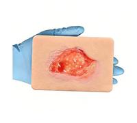 Unhealthy Granulation Wound Simulation Model, Silicone Wound Packing Trainer, Realistic Necrotic Care Training Pad, for Nursing Students Medical Education Teaching