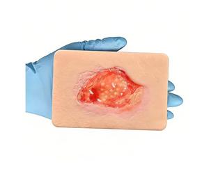 Unhealthy Granulation Wound Simulation Model, Silicone Wound Packing Trainer, Realistic Necrotic Care Training Pad, for Nursing Students Medical Education Teaching