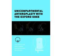 Unicompartmental Arthroplasty with the Oxford Knee