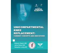 Unicompartmental knee replacement: Current concepts and indications