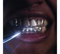 Upchuck - I'm Nice Now