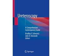 Ureteroscopy: A Comprehensive Contemporary Guide