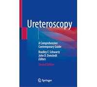 Ureteroscopy: A Comprehensive Contemporary Guide