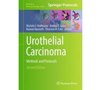 Urothelial Carcinoma : Methods and Protocols