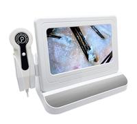 USB Ultrasound Scanner Dermatoscope Microscope - High-Resolution Imaging Device for Skin and Medical Diagnosis, Portable & User-Friendly, Ideal for Healthcare Professionals