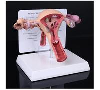 Uterus Model, Pathological and Normal Female Reproductive Organ Model with Display Card and Base for Educational Teaching Demonstration