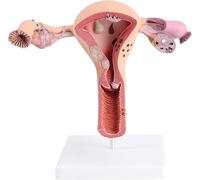 Uterus Ovary Model - Female Reproductive Organs Anatomy Educational Model for Medical Teaching and School Demonstrations