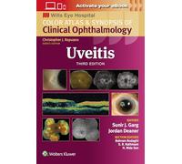Uveitis: Wills Eye Institute Atlas Series