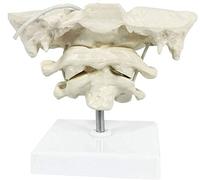 Vacoomcom Model Educational Model Occiput Model - Human Cervical Spine Model Occipital Bone Model PVC Material Atlas and Axis with Occipital Bone Model for Medical Teaching Training Aid (Color : A)