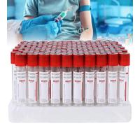 Vacuum Blood Collection Tubes - Glass with Screw Cap, 100 Pieces, Ideal for Laboratory Use