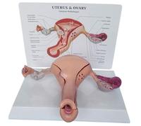 Vagina Ovary Uterus Anatomical Model, Assembly Human Uterus Model, Ovaries and Uterus Pathologies Model