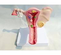 Vaginal Anatomy Display Model Uterine And Ovaries Female Organ Female Anatomical Model Gynecology Ovaries And Uterus Mo