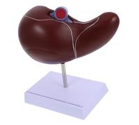 VALICLUD Anatomical Liver Model Medical Teaching Display with Base Realistic Human Organ Anatomy Model for Biology Students and Medical Training Educational Liver Teaching Tool