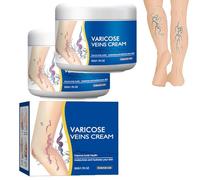 Varicose Veins Cream,Varicose Vein Removal Cream,Vein Relief Cream,Improve Blood Circulation,Tired and Heavy Legs Relief (2pcs)