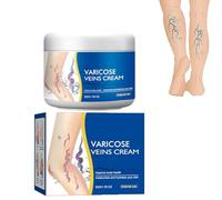 Varicose Veins Cream,Varicose Vein Removal Cream,Vein Relief Cream,Improve Blood Circulation,Tired and Heavy Legs Relief (1pcs)