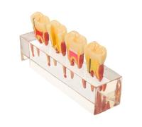 Veemoon Teaching Model for Primary Teeth and Pulp, Resin Oral Anatomy Model with Caries Progression Visualized, Hands-on Practice Training Aid for Schools and Young Patients