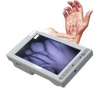Venous Display Light Capillary Imaging Vein Viewer Instrument Lcd Shows Infrared Brightness Adjustment For Hospitals,Clinics