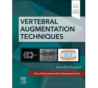 Vertebral Augmentation Techniques