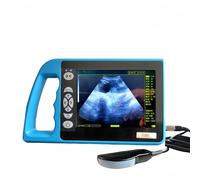 Veterinary Ultrasound Scanner with 128 Element Rectal Probe for Large Animal Diagnostics