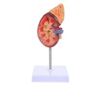 VICASKY Human Kidney Model with Removable Parts Anatomical Teaching Prop for Biology and Medical Study Detailed Internal Structure Demonstration for High School and Medical Students