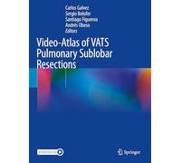 Video-Atlas of VATS Pulmonary Sublobar Resections