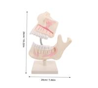 VILLFUL Realistic Plastic Teeth Care Model for Students and Technicians Oral Anatomy Teaching Tool Compact Practice Typodont for Precise Learning and Training