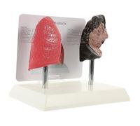 VILLFUL Smoking Lung Comparison Model with Healthy and Diseased Anatomy Realistic Respiratory Teaching Lung Model for Medical Nursing and Physiology Education Vivid Color Detailed