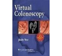 Virtual Colonoscopy