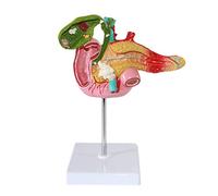 Viscera Pathological Model - Pancreatic Duodenum Gallbladder Pathology Digestive System Model Human Anatomy Science Models - for Medical EducationalAid