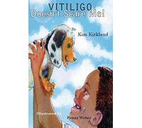 Vitiligo Doesn't Scare Me