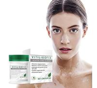 Vitiligo Fix Revitalize Elixir, Vitiligo Treatment Cream, Natural Treat Vitiligo Soothing Cream, Body Vitiligo Care Cream For Reduce White Spot (1pcs)