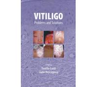Vitiligo: Problems and Solutions (Basic and Clinical Dermatology)