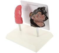 VOSAREA PVC Smoking and Lung Anatomy Model Medical Teaching Aid for Education School Visual Aid for Pathology and Health Knowledge for Students and Doctor-Patient Communication