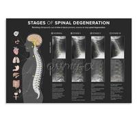 VWWJCCRO Educational Spine Anatomy Poster Detailed Human Backbone Chart Scientific Art Canvas Print Wall Decor for Office Study Room Library (8 X 12 in)