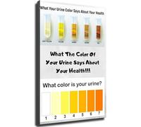 VWWJCCRO Health Awareness Poster Urine Color Chart Body Signals Educational Wall-Art for Bathroom Decor Home Office