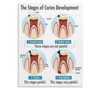 VWWJCCRO Science Illustrated Oral Care Reference Poster Canvas Wall-Art for Research Foyer or Designer Studio(Framed,16x24inch(40x60cm))