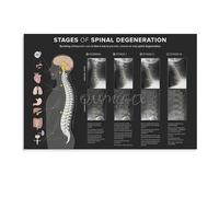 VWWJCCRO The Human Spine Anatomy Art Print Office Wall Decor Canvas Poster for Doctors Clinic Study Room Science Teacher Gift(Unframed,12x18inch(30x45cm))