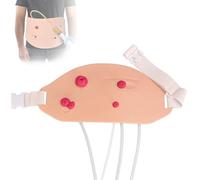 WADPP Wearable Ostomy Care Training Model, Advanced Stoma Simulator with Realistic Fecal & Urine Excretion for Nursing Education, Includes Colostomy, Ileostomy, Loop & Urostomy for Clinical Skills