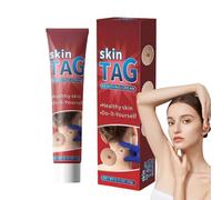 Wart Remover Cream,Effective Wart Removal,Mole Remover,Fast Effective Safe Skin Mole Removal,Wart Treatment for Face & Hands & Body,Wart Remover for Hands,Wart Re-Mover for Face,Flat Wa-rt Remover